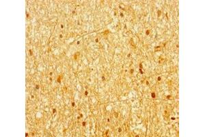 Immunohistochemistry of paraffin-embedded human brain tissue using ABIN7144657 at dilution of 1:100 (Aryl Hydrocarbon Receptor 抗体  (AA 126-353))