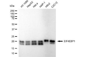 Western blotting analysis using EIF4EBP1 antibody (ABIN7798532). (Recombinant eIF4EBP1 抗体)