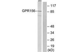 Western blot analysis of extracts from 293 cells, using GPR156 Antibody. (GPR156 抗体  (AA 501-550))