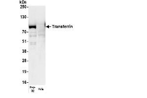 Western Blotting (WB) image for anti-Transferrin (TF) antibody (HRP) (ABIN7449506)