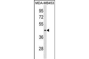 Western blot analysis in MDA-MB453 cell line lysates (35ug/lane). (ALG8 抗体  (N-Term))