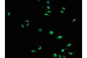 Immunofluorescence staining of A549 cells with ABIN7150685 at 1:100, counter-stained with DAPI. (DAPP1 抗体  (AA 1-280))