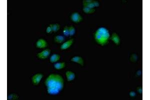 Immunofluorescent analysis of MCF-7 cells using ABIN7152042 at dilution of 1:100 and Alexa Fluor 488-congugated AffiniPure Goat Anti-Rabbit IgG(H+L) (Estrogen Receptor alpha 抗体  (AA 10-591))