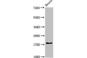 Western Blot Positive WB detected in: Rat brain tissue All lanes: RPL23A antibody at 3 μg/mL Secondary Goat polyclonal to rabbit IgG at 1/50000 dilution Predicted band size: 18 kDa Observed band size: 18 kDa (RPL23A 抗体  (AA 1-92))