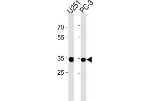 Western Blotting (WB) image for anti-Ribosomal Protein, Large, P0 Pseudogene 6 (RPLP0P6) antibody (ABIN3004613) (RPLP0P6 抗体)