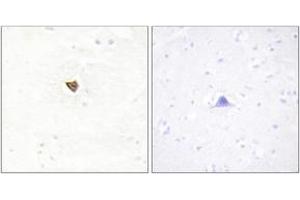 Immunohistochemistry analysis of paraffin-embedded human brain tissue, using JAKMIP2 Antibody. (JAKMIP2 抗体  (AA 761-810))