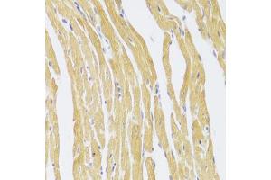Immunohistochemistry of paraffin-embedded mouse heart using CSRP3 Antibody (ABIN2562048) at dilution of 1:100 (40x lens). (CSRP3 抗体)