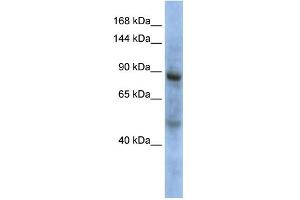 WB Suggested Anti-ZHX3 Antibody Titration: 0. (ZHX3 抗体  (Middle Region))