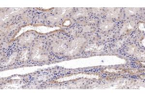 Immunohistochemistry (IHC) image for anti-Solute Carrier Family 12 (Sodium/Chloride Transporters), Member 3 (SLC12A3) (AA 3-146) antibody (ABIN7426973)