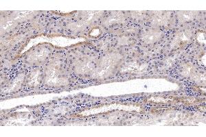 Detection of NCCT in Human Kidney Tissue using Monoclonal Antibody to Na-Cl Cotransporter (NCCT) (SLC12A3 抗体  (AA 3-146))