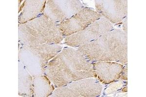 Immunohistochemistry analysis of paraffin-embedded rat skeletal muscle using,PPAPDC3 (ABIN7075036) at dilution of 1: 4000 (PPAPDC3 抗体)