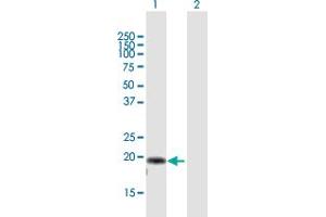 Western Blot analysis of AP3S2 expression in transfected 293T cell line by AP3S2 MaxPab polyclonal antibody. (AP3S2 抗体  (AA 1-193))