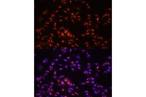 Immunofluorescence (IF) image for anti-Dyskeratosis Congenita 1, Dyskerin (DKC1) (AA 1-180) antibody (ABIN6139635)
