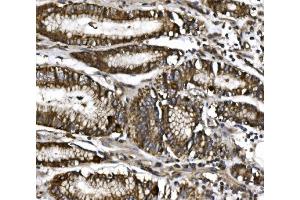 IHC analysis of MitoNEET/CISD1 using anti-MitoNEET/CISD1 antibody (ABIN7601089).