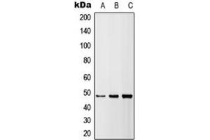 Western blot analysis of DR5 expression in HEK293T (A), A549 (B), H9C2 (C) whole cell lysates. (TNFRSF10B 抗体  (Center))