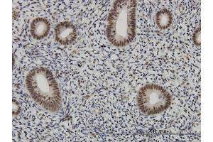 Immunoperoxidase of monoclonal antibody to AFF4 on formalin-fixed paraffin-embedded human endometrium. (AFF4 抗体  (AA 1-108))