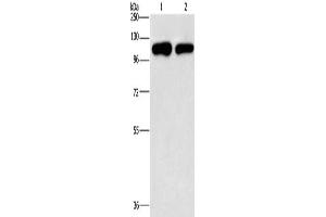Gel: 10 % SDS-PAGE, Lysate: 40 μg, Lane 1-2: A431 cells, hela cells, Primary antibody: ABIN7191891(PIP5K1C Antibody) at dilution 1/500, Secondary antibody: Goat anti rabbit IgG at 1/8000 dilution, Exposure time: 2 minutes (PIP5K1C 抗体)
