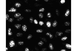 Immunofluorescent staining of HeLa cells. (Ki-67 抗体)