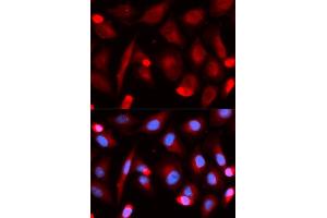 Immunofluorescence (IF) image for anti-Friend Leukemia Virus Integration 1 (FLI1) antibody (ABIN1876845) (FLI1 抗体)
