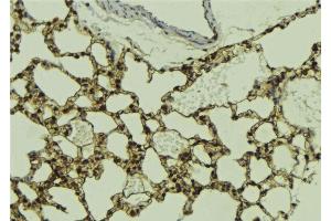 ABIN6268895 at 1/100 staining Mouse lung tissue by IHC-P. (HDAC5 抗体  (C-Term))