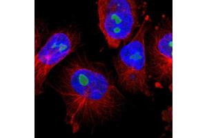 Immunofluorescent staining of human cell line U-251 MG with TNFAIP1 polyclonal antibody  shows positivity in nucleoli. (TNFAIP1 抗体  (AA 80-170))