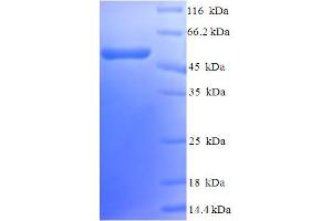 SDS-PAGE (SDS) image for Calponin 1 (CNN1) (AA 1-297), (full length) protein (His-SUMO Tag) (ABIN5709301) (CNN1 Protein (AA 1-297, full length) (His-SUMO Tag))