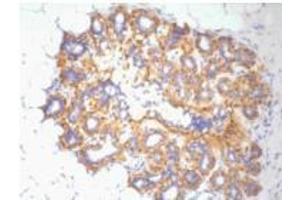 Immunohistochemistry (IHC) staining of Human ovary tissue, diluted at 1:200 (beta Actin 抗体)