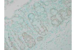 Immunohistochemistry analysis using Rabbit Anti-Ubiquitin Polyclonal Antibody (ABIN361830 and ABIN361831).