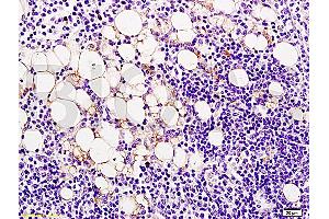 Formalin-fixed and paraffin embedded rat lymphoma tissue labeled Anti-Ang-2/Angiopoietin-2 Polyclonal Antibody, Unconjugated (ABIN671781) at 1:200, followed by conjugation to the secondary antibody and DAB staining (Angiopoietin 2 抗体  (AA 401-496))