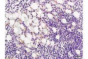 Formalin-fixed and paraffin embedded rat lymphoma tissue labeled Anti-Ang-2/Angiopoietin-2 Polyclonal Antibody, Unconjugated (ABIN671781) at 1:200, followed by conjugation to the secondary antibody and DAB staining