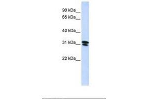 Image no. 1 for anti-Ring Finger Protein 182 (RNF182) (AA 72-121) antibody (ABIN6739169) (RNF182 抗体  (AA 72-121))