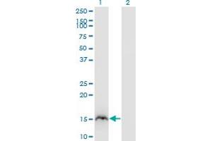 Western Blot analysis of RBP2 expression in transfected 293T cell line by RBP2 monoclonal antibody (M02), clone 3G12. (RBP2 抗体  (AA 45-134))