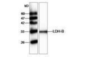 Image no. 1 for anti-Lactate Dehydrogenase B (LDHB) antibody (ABIN791438) (LDHB 抗体)