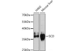 Western blot analysis of extracts of various cell lines using SCD Polyclonal Antibody at dilution of 1:1000. (SCD 抗体)