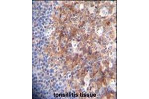 RCO Antibody (N-term) A immunohistochemistry analysis in forlin fixed and paraffin embedded hun tonsillitis tissue followed by peroxidase conjugation of the secondary antibody and DAB staining. (MARCO 抗体  (AA 13-40))
