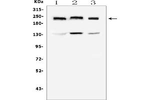 Western blot analysis of Collagen IV using anti-Collagen IV antibody (ABIN5692826).