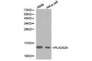 Western Blotting (WB) image for anti-Phospholipase A2, Group IIA (Platelets, Synovial Fluid) (PLA2G2A) antibody (ABIN1874153) (PLA2G2A 抗体)