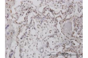 Immunoperoxidase of purified MaxPab antibody to RPA4 on formalin-fixed paraffin-embedded human placenta.