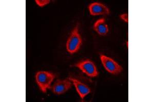 Immunofluorescent analysis of mGLUR6 staining in NIH3T3 cells. (Metabotropic Glutamate Receptor 6 抗体  (C-Term))