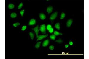 Immunofluorescence of purified MaxPab antibody to DDX20 on HeLa cell. (DDX20 抗体  (AA 1-824))