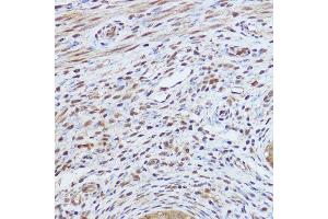 Immunohistochemistry of paraffin-embedded mouse uterus using GLI1 Rabbit pAb (ABIN7271533) at dilution of 1:150 (40x lens). (GLI1 抗体  (AA 200-300))