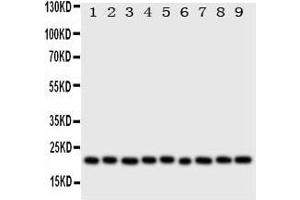 Western Blotting (WB) image for anti-Cytoglobin (CYGB) (AA 50-68), (N-Term) antibody (ABIN3043127) (CYGB 抗体  (N-Term))