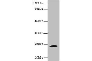 Western blot All lanes: TPPP antibody IgG at 1. (Tppp 抗体  (AA 1-219))