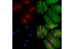 ABIN6257088 and ABIN6273791 staining  cells by IF/ICC. (CSNK2A2 抗体  (N-Term))