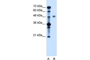 Western Blotting (WB) image for anti-Solute Carrier Family 39 (Zinc Transporter), Member 6 (SLC39A6) antibody (ABIN2462750) (SLC39A6 抗体)
