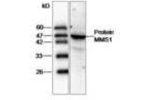 Image no. 1 for anti-Proteasome (Prosome, Macropain) 26S Subunit, ATPase, 2 (PSMC2) antibody (ABIN791429) (PSMC2 抗体)