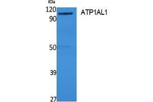 Western Blotting (WB) image for anti-ATPase, H+/K+ Transporting, Nongastric, alpha Polypeptide (ATP12A) (Internal Region) antibody (ABIN3178130) (ATP12A 抗体  (Internal Region))