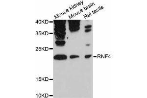 Western blot analysis of extracts of various cell lines, using RNF4 antibody (ABIN6291207) at 1:3000 dilution. (RNF4 抗体)