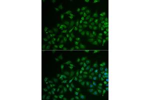 Immunofluorescence analysis of U2OS cells using MPP2 antibody (ABIN5974010). (MPP2 抗体)