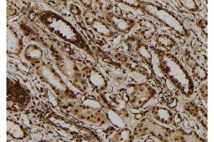 ABIN6273110 at 1/100 staining Human kidney tissue by IHC-P. (DHX9 抗体  (C-Term))